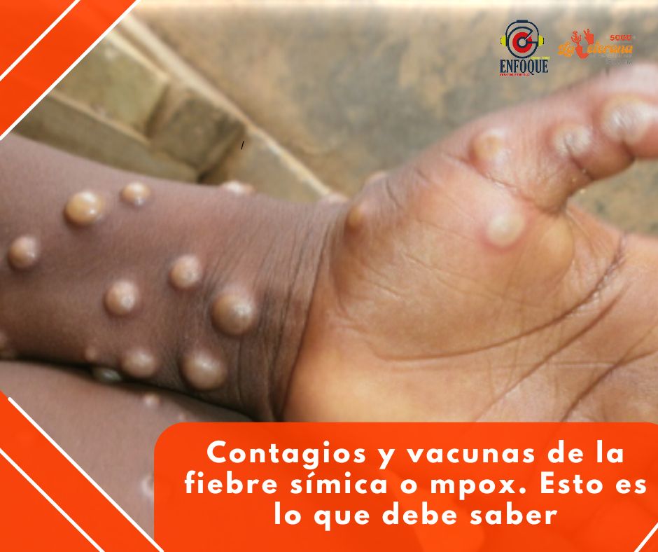 #Especial: Contagios y vacunas de la fiebre símica o mpox. Esto es todo lo que debe saber